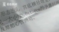西安中航工业西安医院做个人流假手术 手术后胎儿乃在肚中 问责！