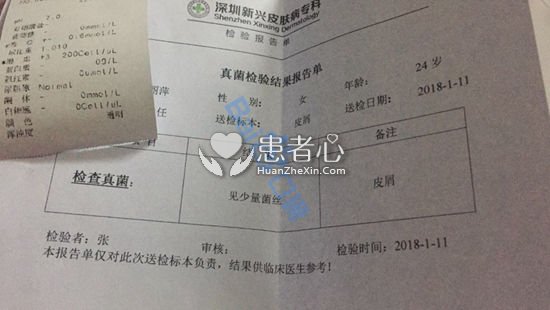 深圳新兴皮肤病专科门诊治脱发 梅花针扎头皮一疗程一千多