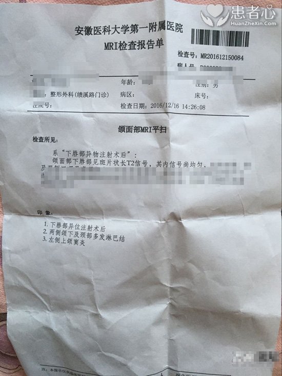 合肥博士整形医院打玻尿酸把我毁容 事后还威胁我