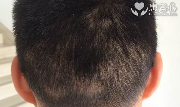 我要曝光南京新生植发医院欺诈坑骗