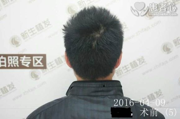 我要曝光南京新生植发医院欺诈坑骗
