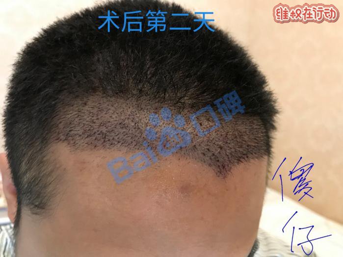 广州科发源植发