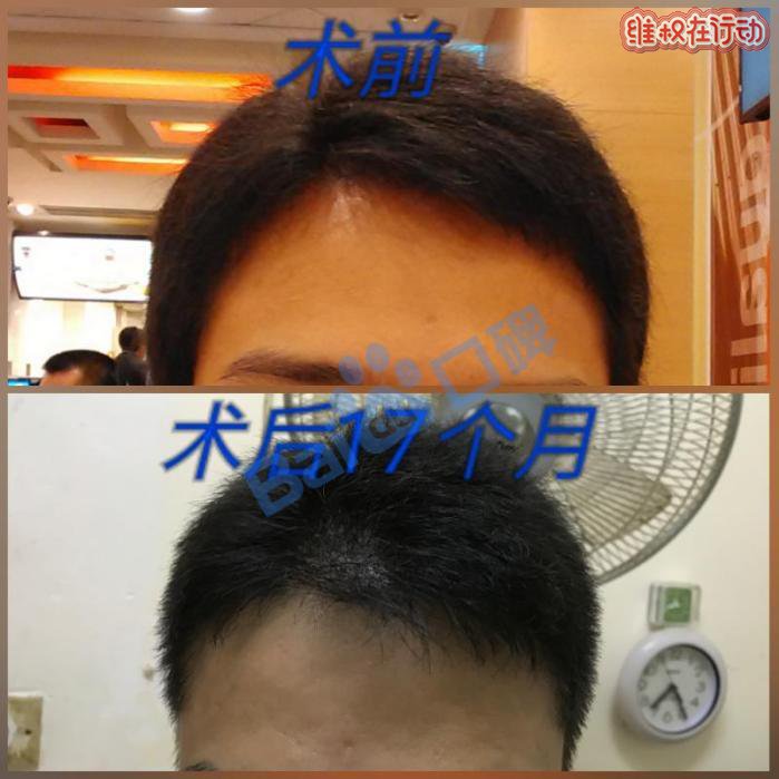 广州科发源植发