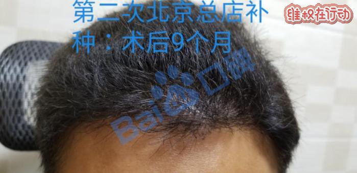 广州科发源植发