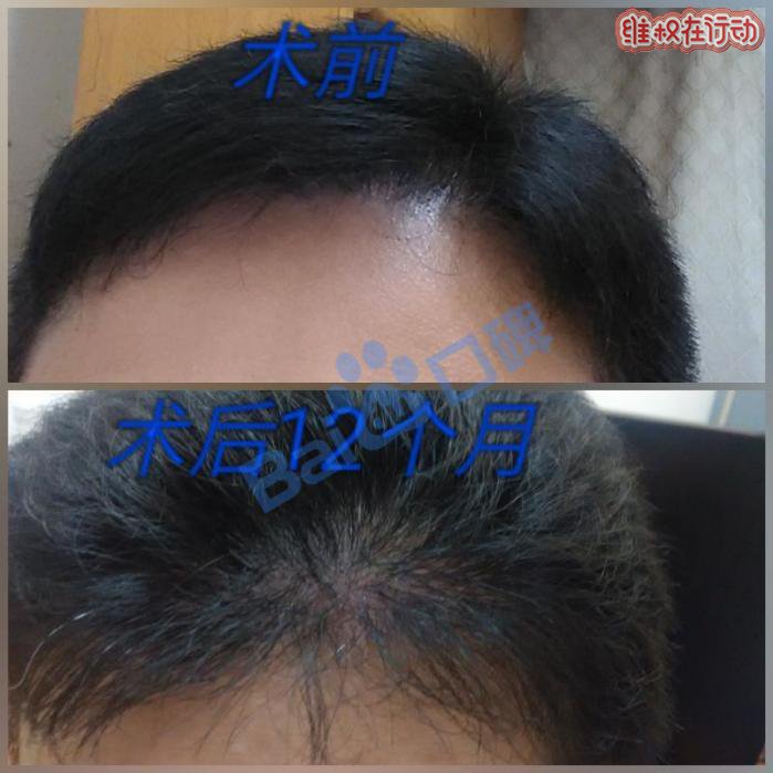 广州科发源植发