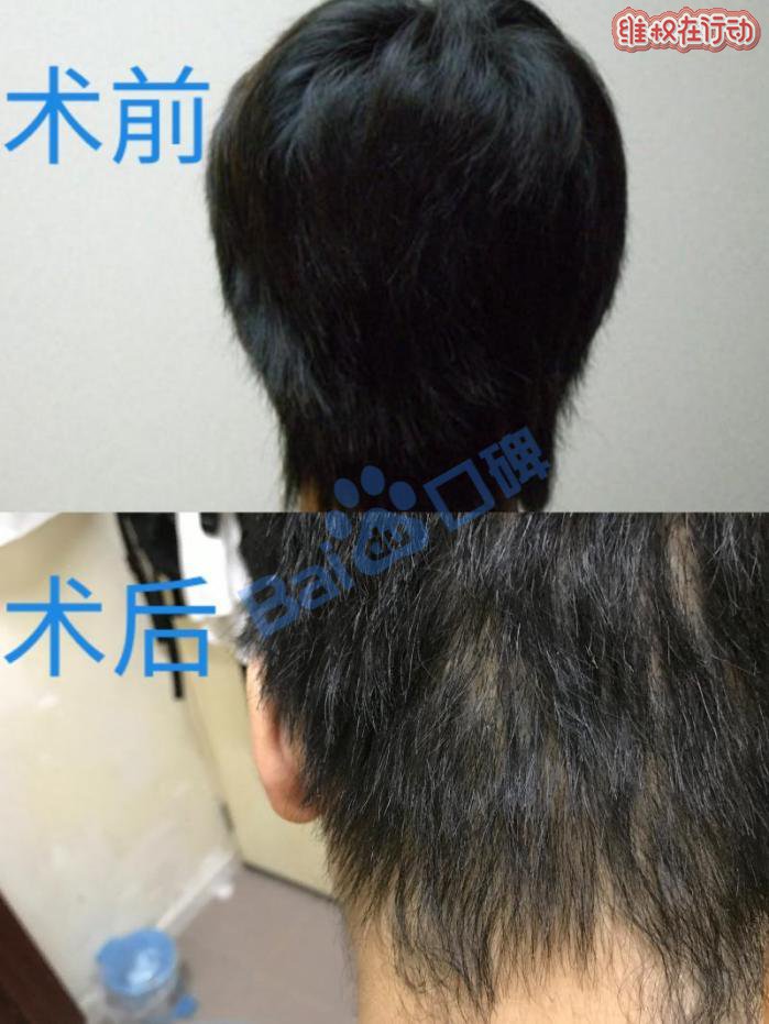 广州科发源植发