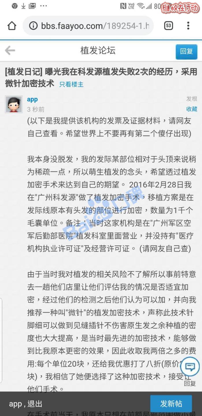 广州科发源植发