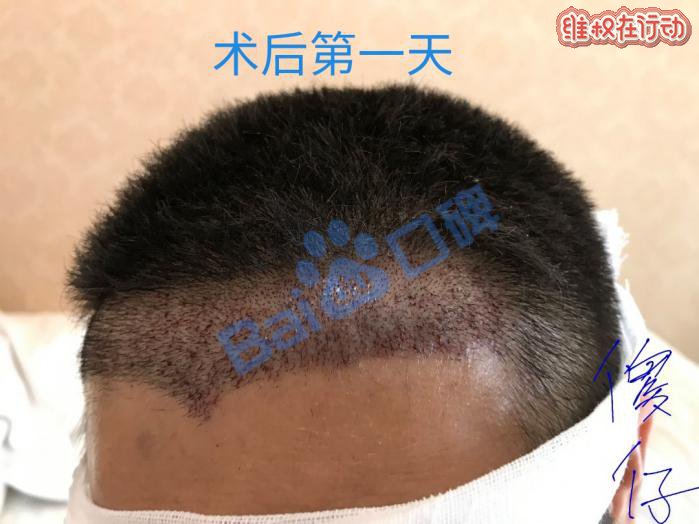 广州科发源植发