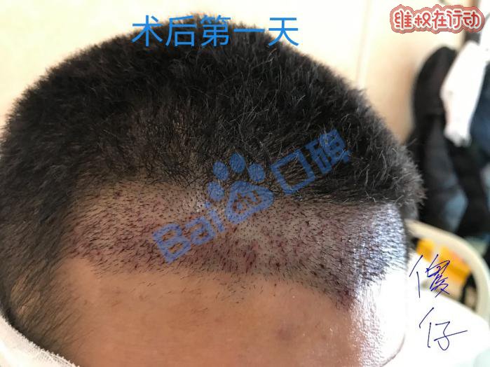 广州科发源植发