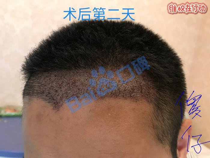广州科发源植发