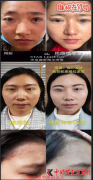 揭秘传奇微脸精华喷雾的营销骗术 P图神技遭质疑
