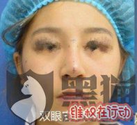 扬州美贝尔整形医院怎么样？扬州美贝尔整形医院失败维权