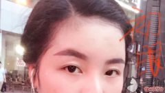 Yestar上海艺星整形医院怎么样？上海艺星整形李建兵毁我眼睛和鼻子