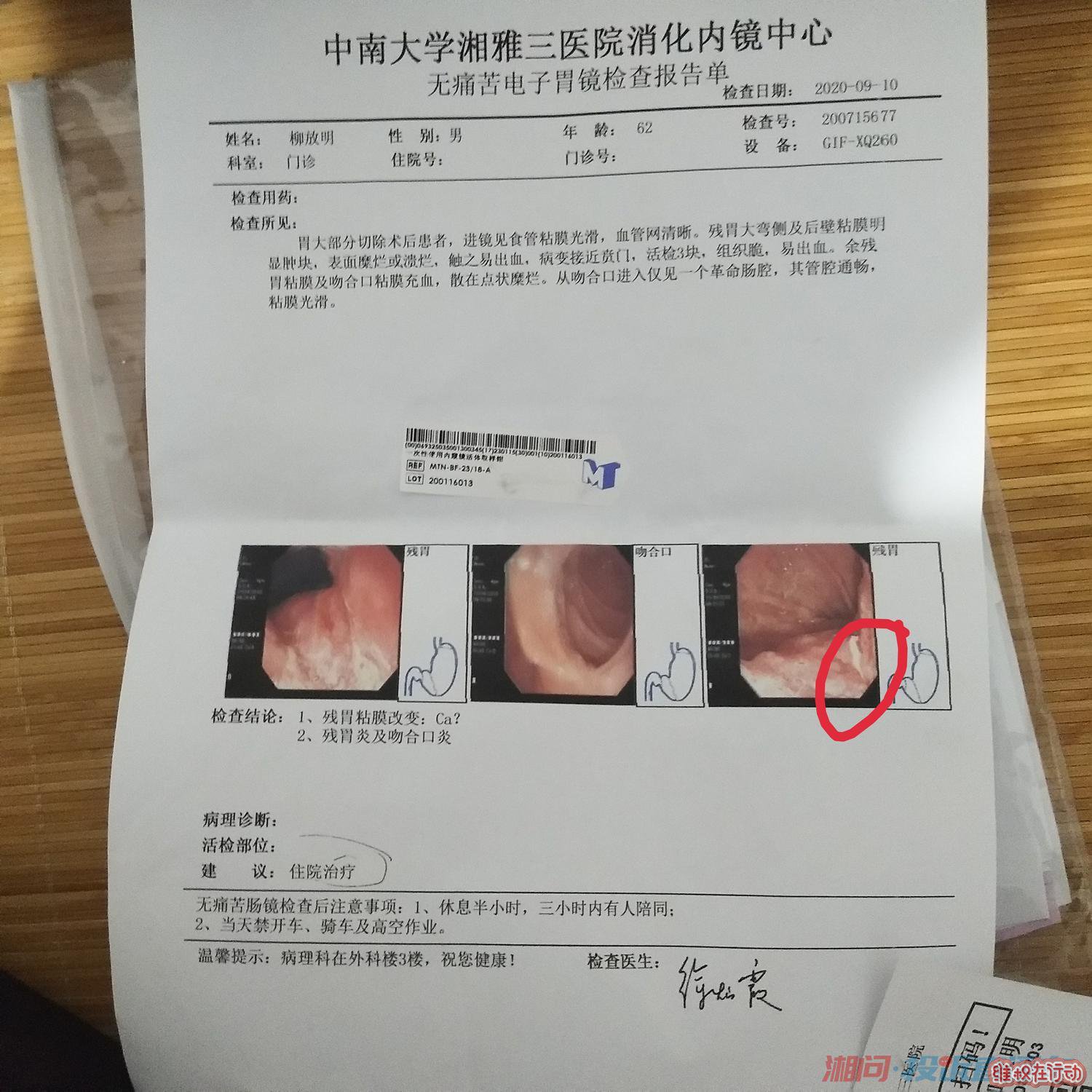 今年胃镜报告
