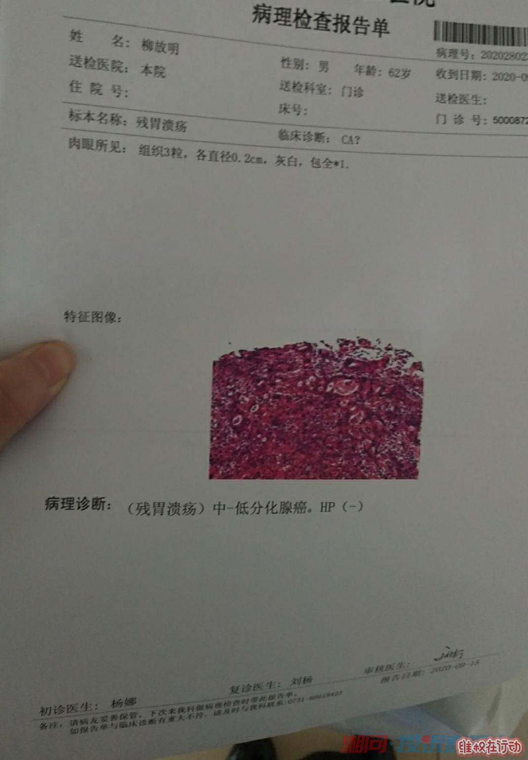 今年病理报告