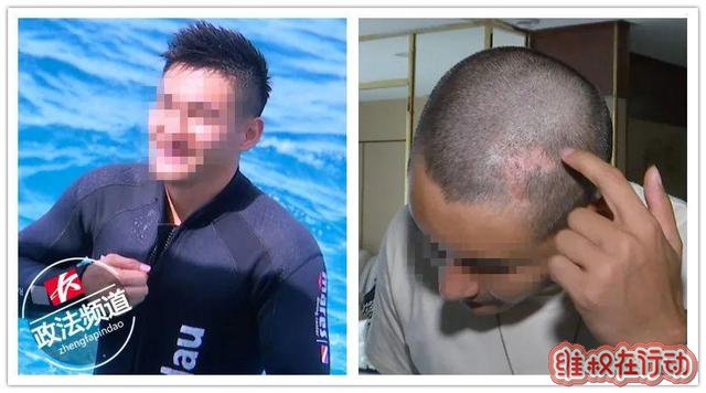 长沙安曼达整形医院