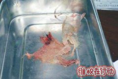 湖南湘雅博爱康复医院口腔手术10个月后伤口“长出”了纱布！也太坑了吧