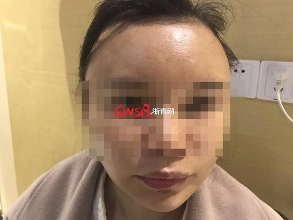 杭州美莱整形医院