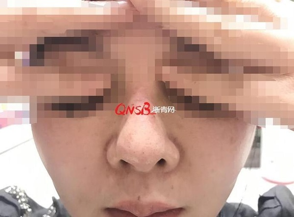 杭州美莱整形医院
