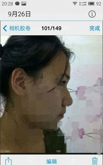 郑州美美整形医院