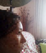 郑州美美整形医院现天价整鼻失败 整容变成了毁容 让人情何以堪？