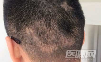 南京新生植发医院