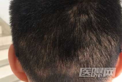 南京新生植发医院