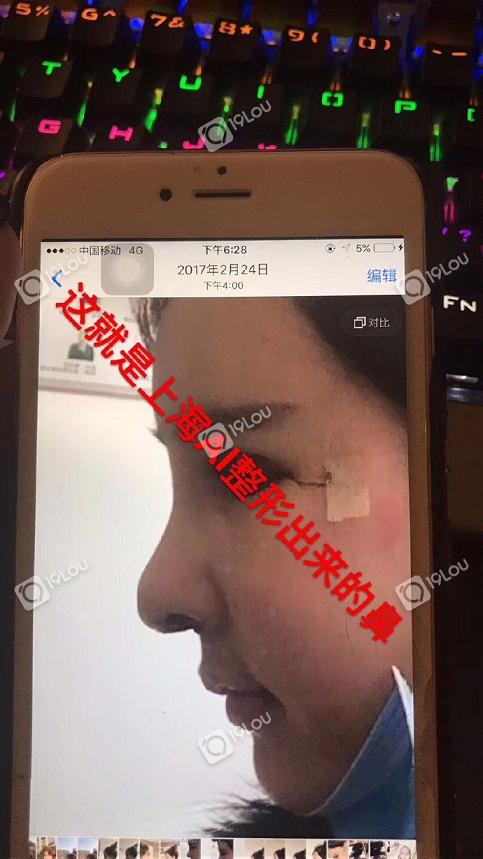 上海AL国际整形医院