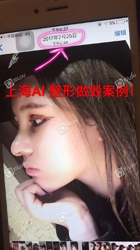 上海AL国际整形医院