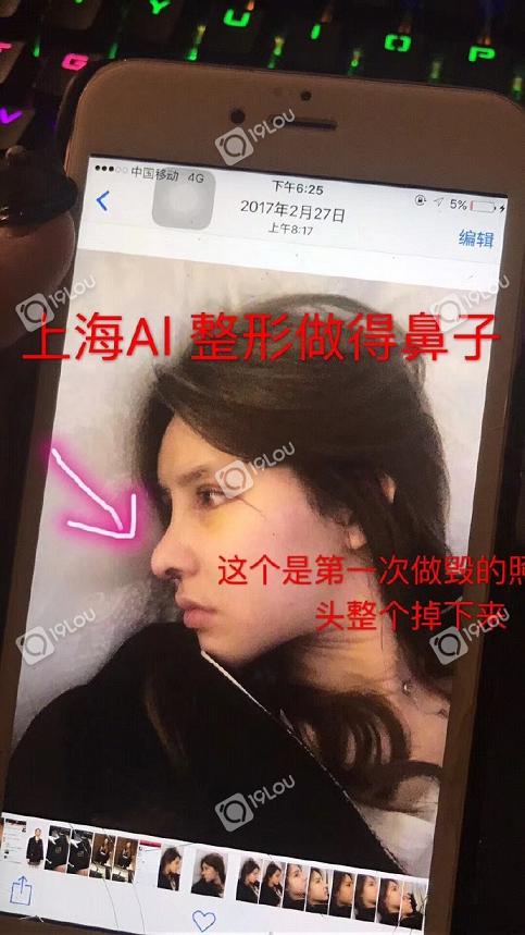 上海AL国际整形医院