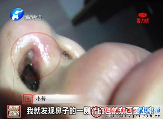 郑州爱美丽整形医院