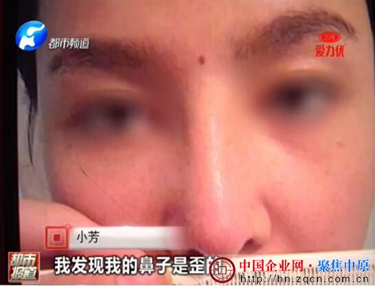 郑州爱美丽整形医院