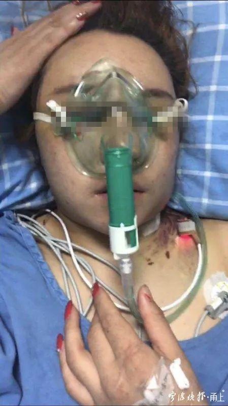 台州女子被拉到宁波这家医美整容 结果在ICU抢救18天……