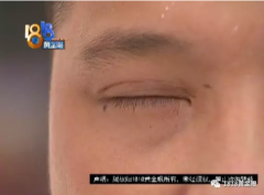整形手术后小伙慌了！杭州静丽医疗整形医院：他不是我们的客户！