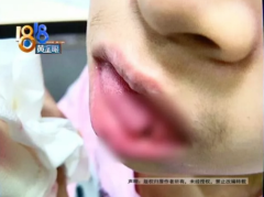 去杭州艾维口腔补牙舌头被划伤缝八针，疼的浑身发抖！