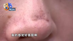 “技术院长”是专科毕业，宁波美塑凤凰医疗美容医院的宣传却造假了？
