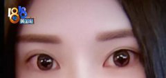杭州华山连天美医疗美容医院整形后，经常出现流眼泪，频繁眨眼睛……