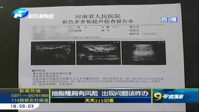 郑州曹乐医疗整形：抽脂隆胸不靠谱  出现问题沟通难