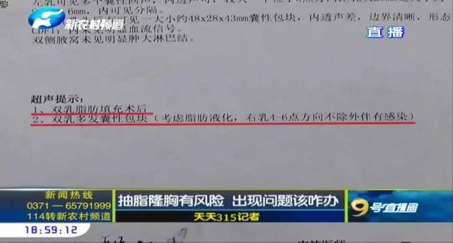 郑州曹乐医疗整形：抽脂隆胸不靠谱  出现问题沟通难