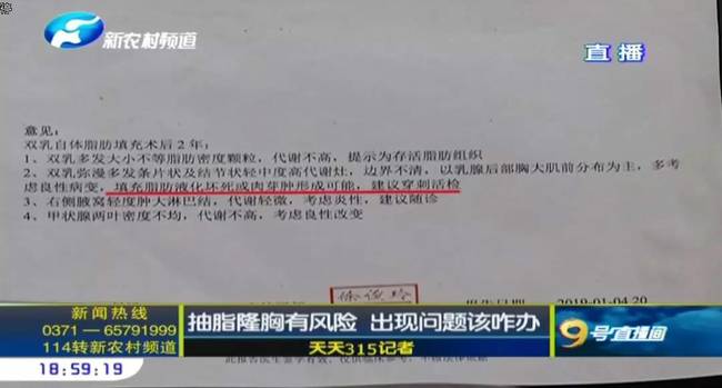 郑州曹乐医疗整形：抽脂隆胸不靠谱  出现问题沟通难