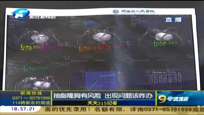 郑州曹乐医疗整形：抽脂隆胸不靠谱  出现问题沟通难