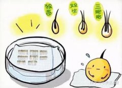 植发技术|毛囊克隆技术是黑科技还是骗局？