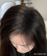 智商税还是特效药？防脱洗发水和育发液究竟有用吗？