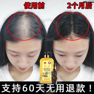 防脱发最好的洗发水(防断发脱发的洗发水) 防脱发最好的洗发水(防断发脱发的洗发水)