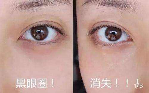 哪种眼霜去黑眼圈效果好