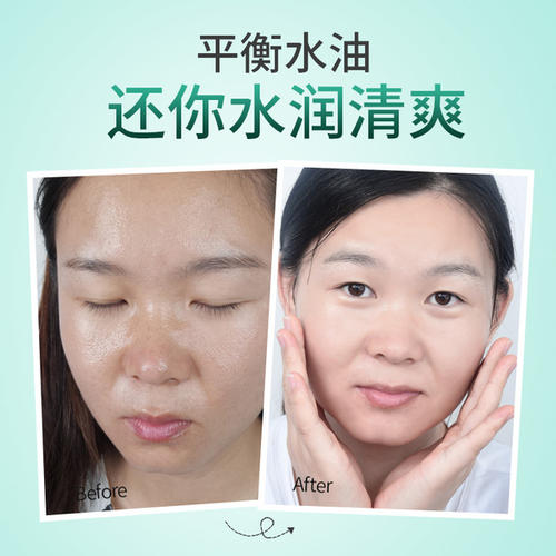 油性皮肤用什么乳液