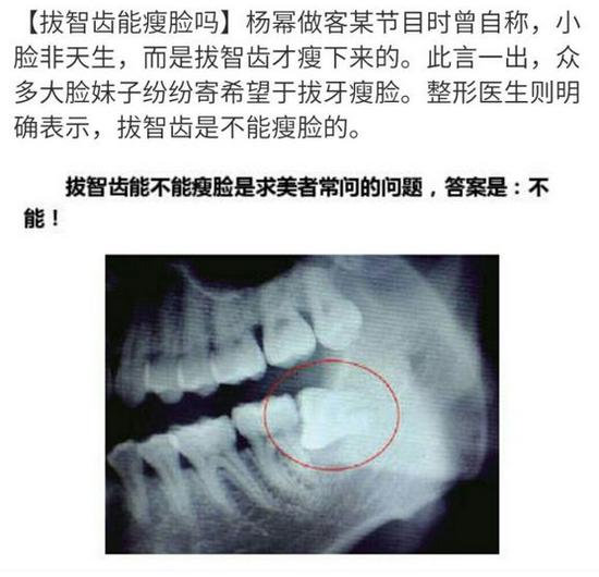 杨幂为什么这么不招人待见?