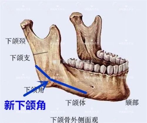 下颌角磨骨科普示意图